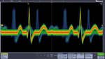 Digital phosphor technology with FastAcq enables greater than 280,000 wfms/s waveform capture rate and real-time color-intensity grading